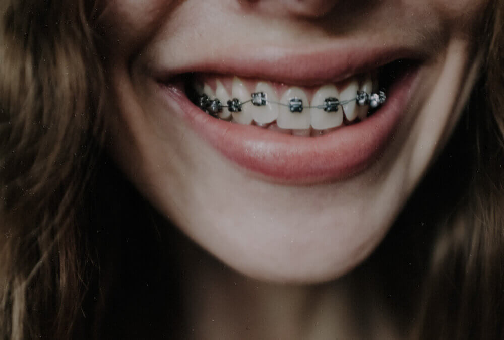 Teen Smiling with Metal Braces